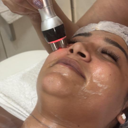 Abrakadabra spa #beograd Tretman lica Radiotalasni lifting lica + masaža lica Radiotalasni tretman 
