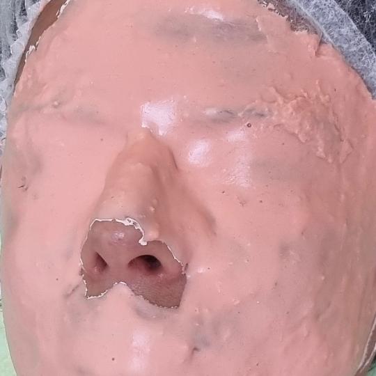 Emilly #beograd Tretman lica Skin boosters tretman lica Idealan tretman pred odmor ili neki važan d