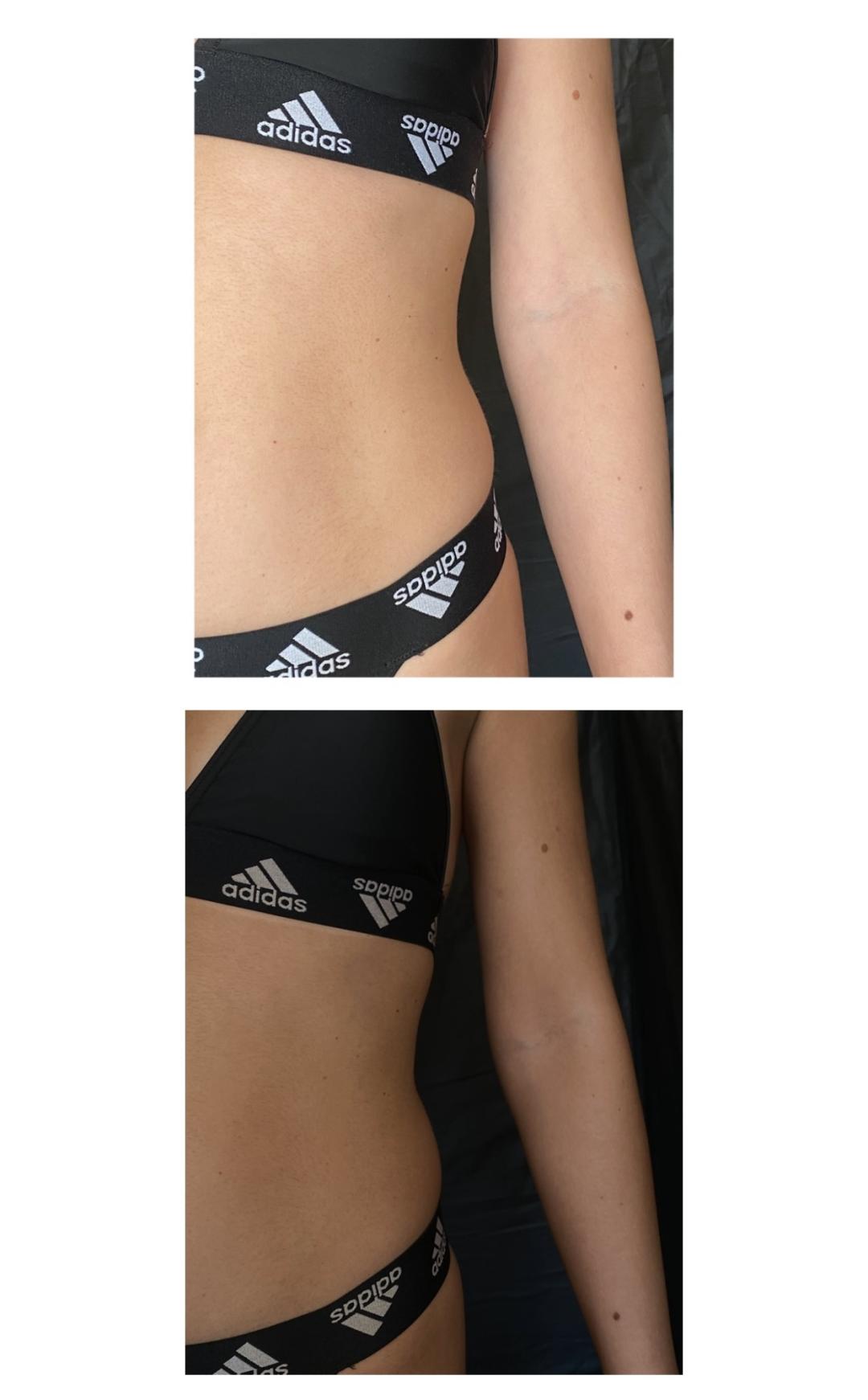 Gold Club #beograd Air brush potamnjivanje kože Classic MineProfessional - spray tan