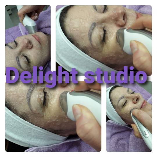 Laser centar Delight #beograd Piling lica Tretman lica frakcionom radiofrekvencijom