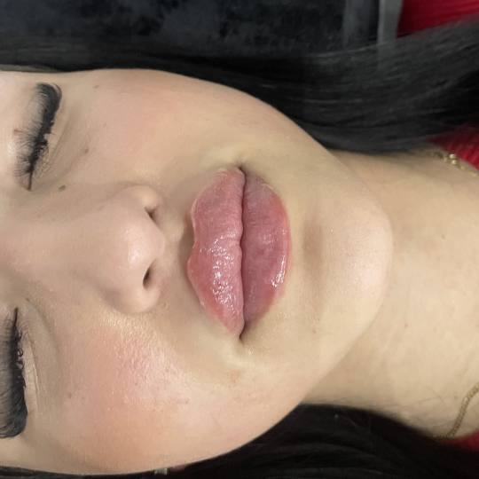 Estetik beauty centar usluga