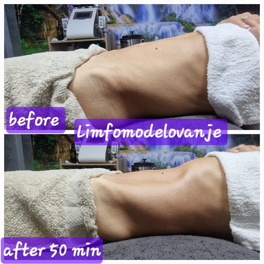 Fit limfomodelovanje - Seaside beauty, Beograd Opšta masaža Masaža Opšta masaža, Beograd, Novi Beograd Fontana, Tošin bunar