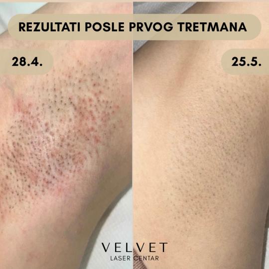 Velvet usluga