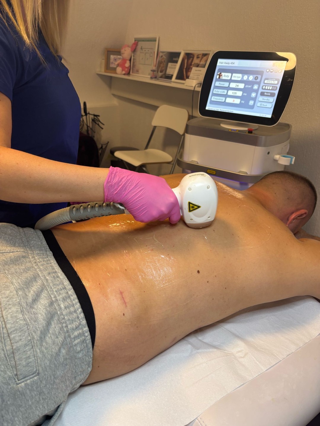 Ordinacija Epil Medic #beograd Laserska epilacija Laserska epilacija leđa - za muškarce