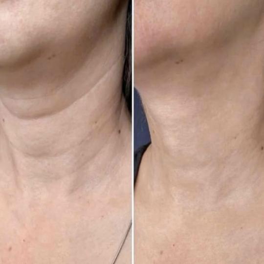 Amelini beauty concept usluga