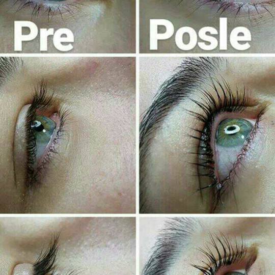 La Reina #beograd lashlifting & botox trepavica