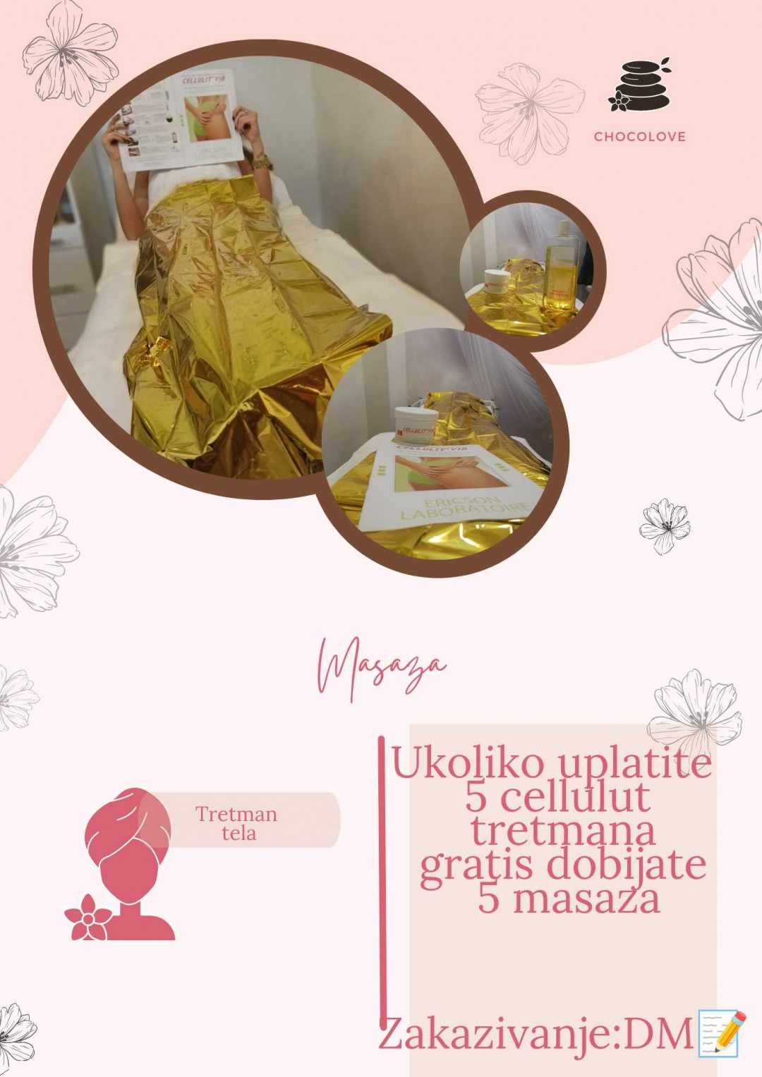 Choco Love #beograd Tretmani tela Cellulit Burn Dstres 5 tretmana + 5 masaza- Ericson Laboratorie