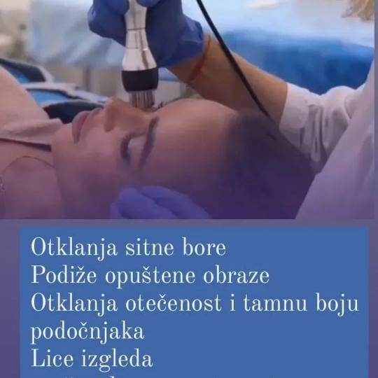 Ceragem Relax #krusevac Radiotalasni i ultrazvučni tretmani Radiotalasni lifting - lica + vrat