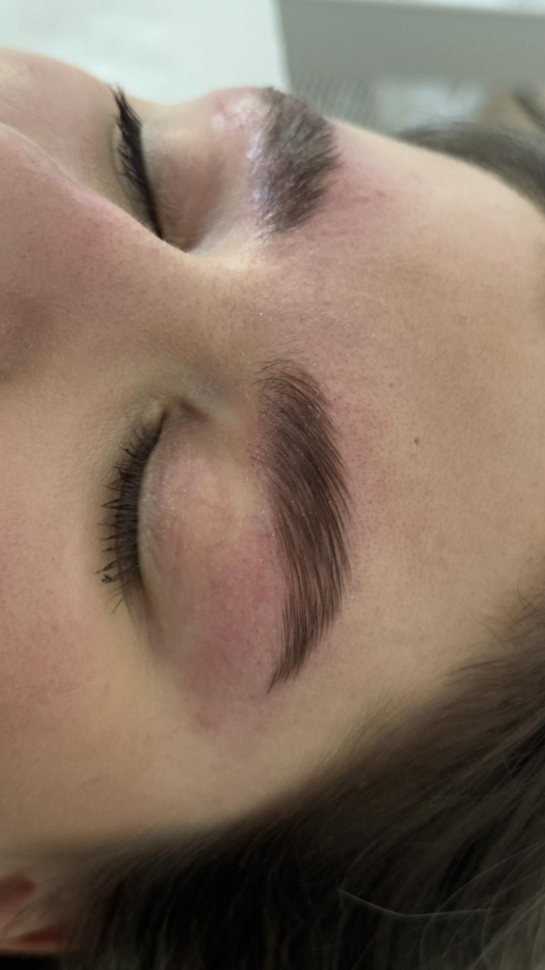 Brow lift - Lola esthetic center, Beograd Obrve Lice Obrve, Beograd, Novi Beograd blokovi, Belville, Savski kej