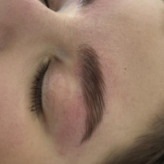 Lola esthetic center #beograd Obrve Brow lift