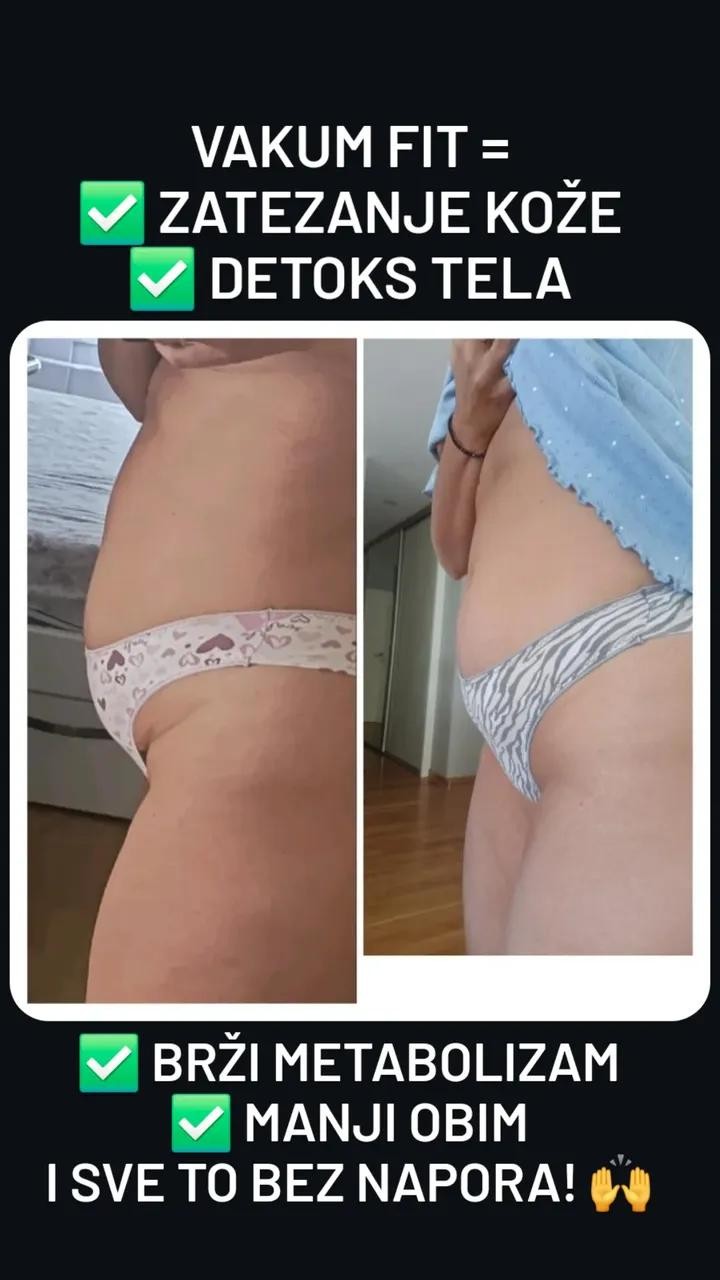 Cest la vie beauty #beograd Tretmani tela Vakuum pakovanje