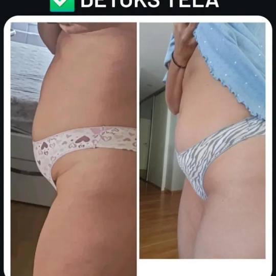 Cest la vie beauty #beograd Tretmani tela Vakuum pakovanje