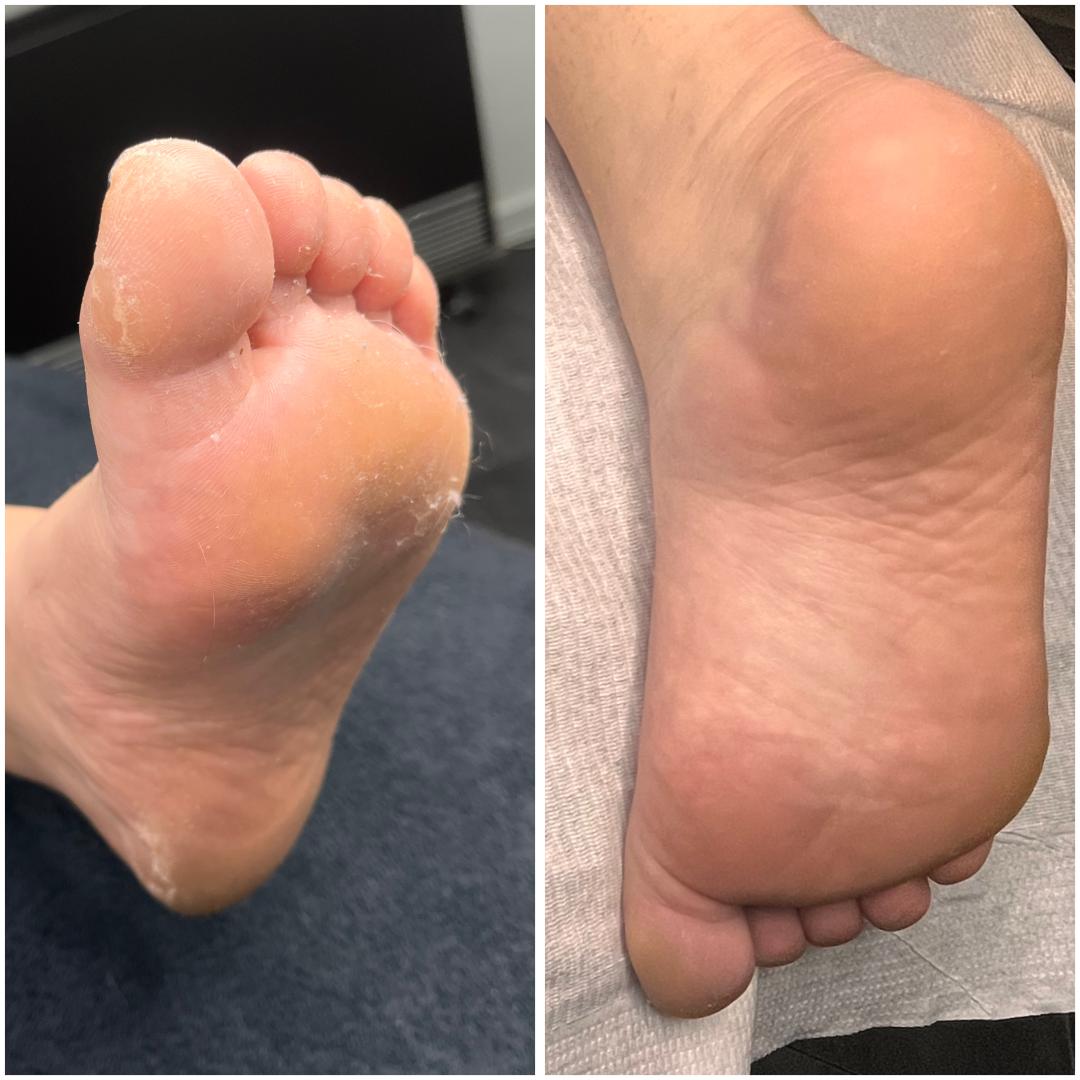 Belle Ana #beograd Estetski pedikir Ruski pedikir