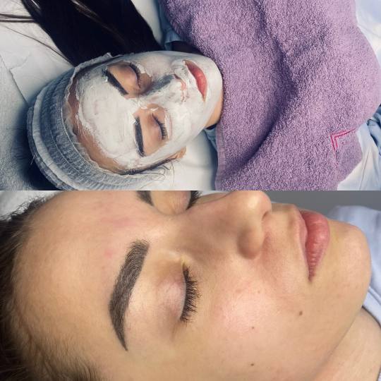 Beauty by Nevena Panić #beograd Tretman lica Higijenski tretman lica