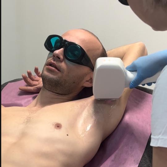 Beauty Lab Ženska Tajna #novisad Laserska epilacija Laserska epilacija celih nogu - za muškarce Da