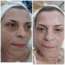 Vila Beauty Studio #beograd Tretman lica BB glow regija oka
