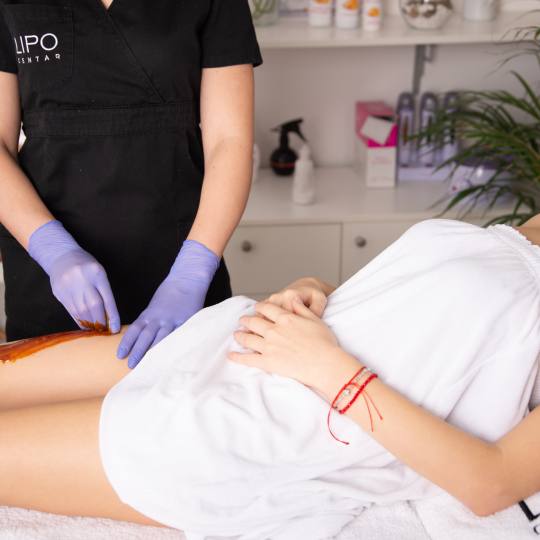 Lipo Centar #beograd Depilacija nogu Depilacija celih nogu šećernom pastom (ručna) - za dame