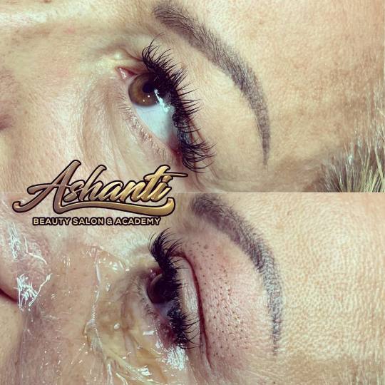 Ashanti Beauty Salon & Academy #beograd Tretman lica Plasma pen - gornji kapci