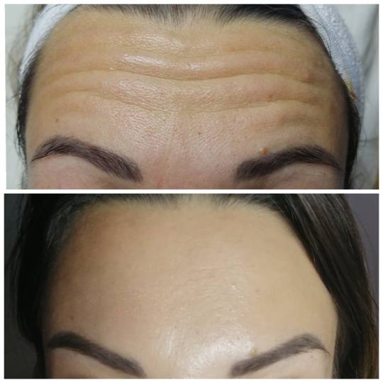 Massage Centar Vesna Joksimović #kragujevac