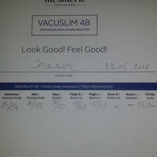 Magični dodir #beograd Anticelulit masaža Vakuslim 48 rezultati VACUSLIM 48 ANTICELLULITE & SLIMMI