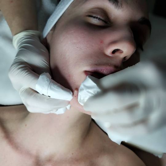 Kalina Beauty #beograd Tretman lica Klasičan tretman lica