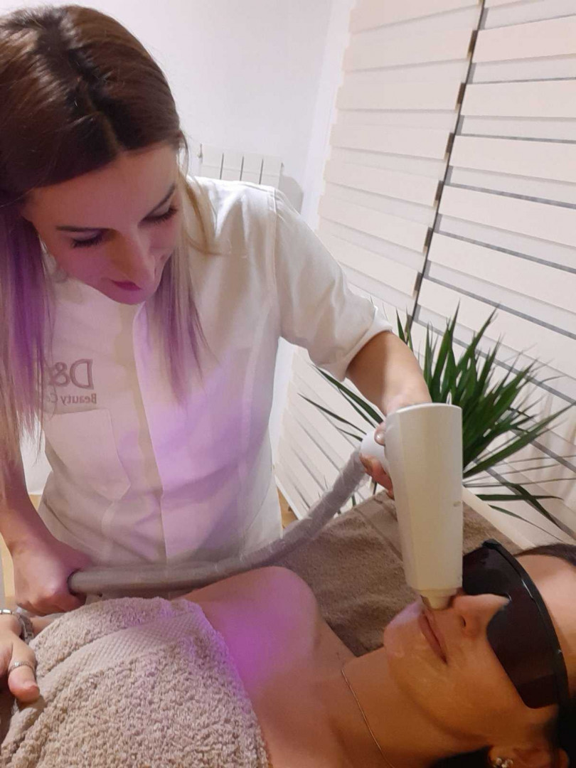 D&D Beauty Center #beograd Laserska epilacija Laserska epilacija nausnica - za dame