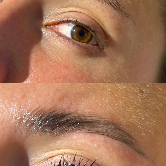 Lola esthetic center usluga