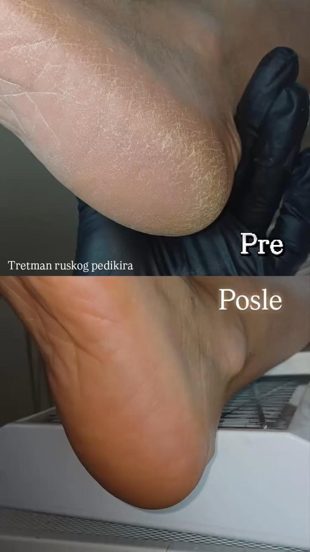 La Hermosa Beauty Studio #beograd Estetski pedikir Ruski pedikir