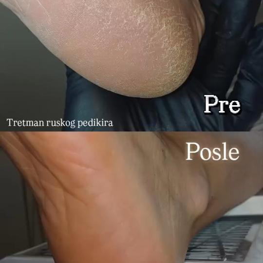 La Hermosa Beauty Studio #beograd Estetski pedikir Ruski pedikir Nokti