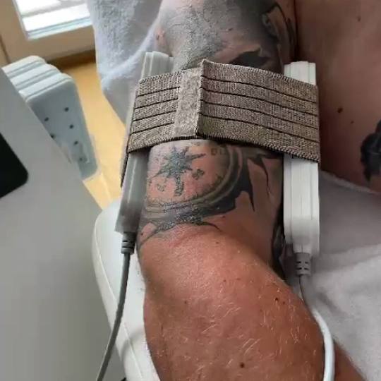 Lipolaser Centar - Matrix021 #novisad Tretmani tela 👉Neinvazivna liposukcija Diodnim laserom, zat