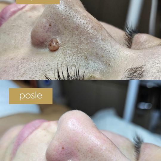 Beautique spa usluga