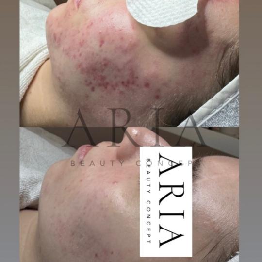 Aria Beauty Concept usluga