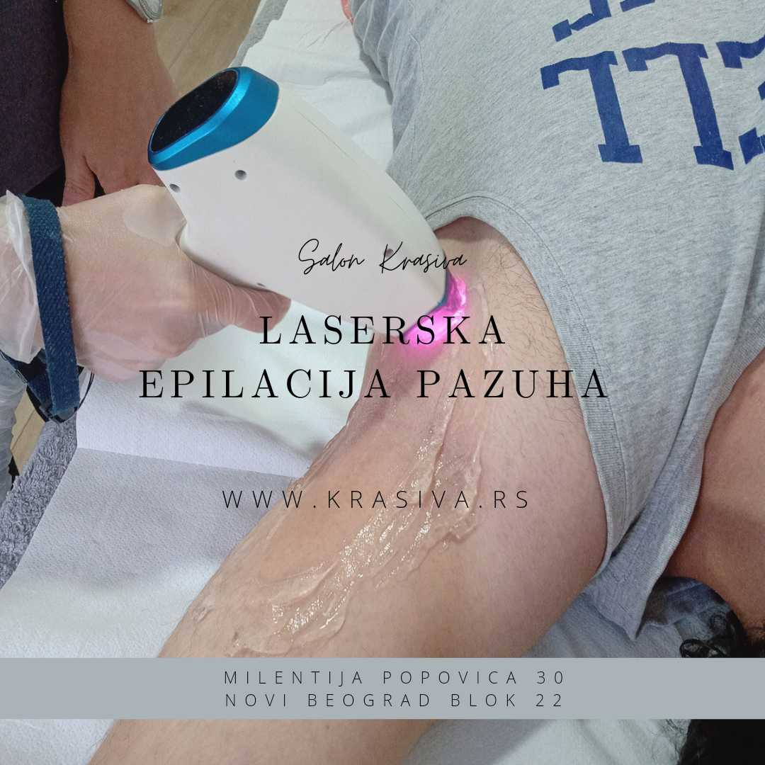 Krasiva 2 #beograd Laserska epilacija Laserska epilacija pazuha - za muškarce