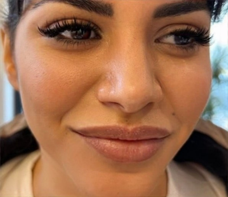 Nadogradnja svilenih trepavica - 1 na 1 - Esthetique Privé, Beograd Nadogradnja trepavica Lice Nadogradnja trepavica, Beograd, Centar, Stari grad, Dorćol