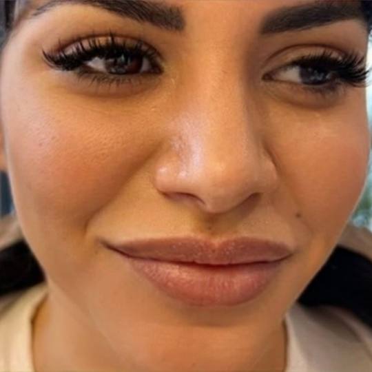 Esthetique Privé #beograd Nadogradnja trepavica Nadogradnja svilenih trepavica - 1 na 1