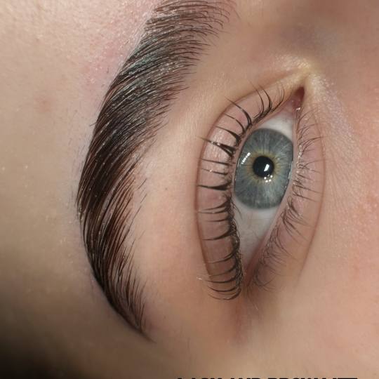 Kult #beograd Obrve Brow lift + botox