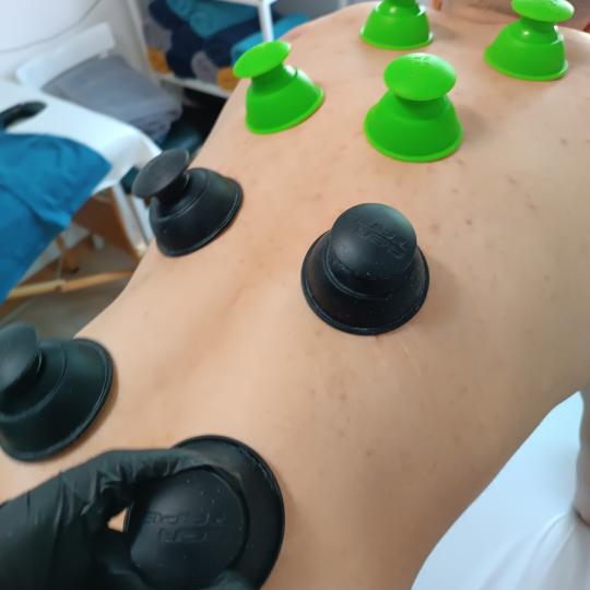 Neokinetika #novisad Tretmani tela Myofascialni cupping - ventuze