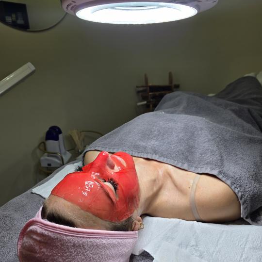 Starmedic #beograd Tretman lica Antiage tretman lica