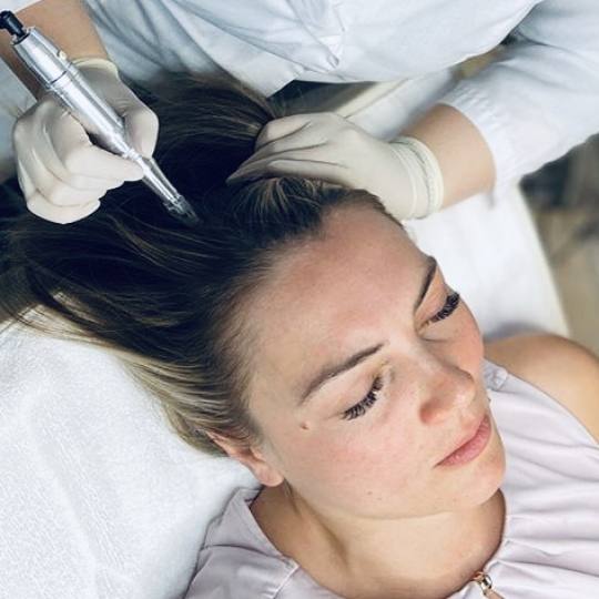 Unica Estetica #nis Tretman lica Microneeding tretman vlasišta