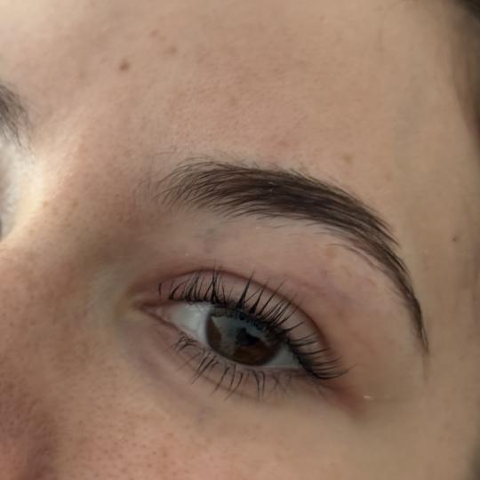 Lola esthetic center usluga