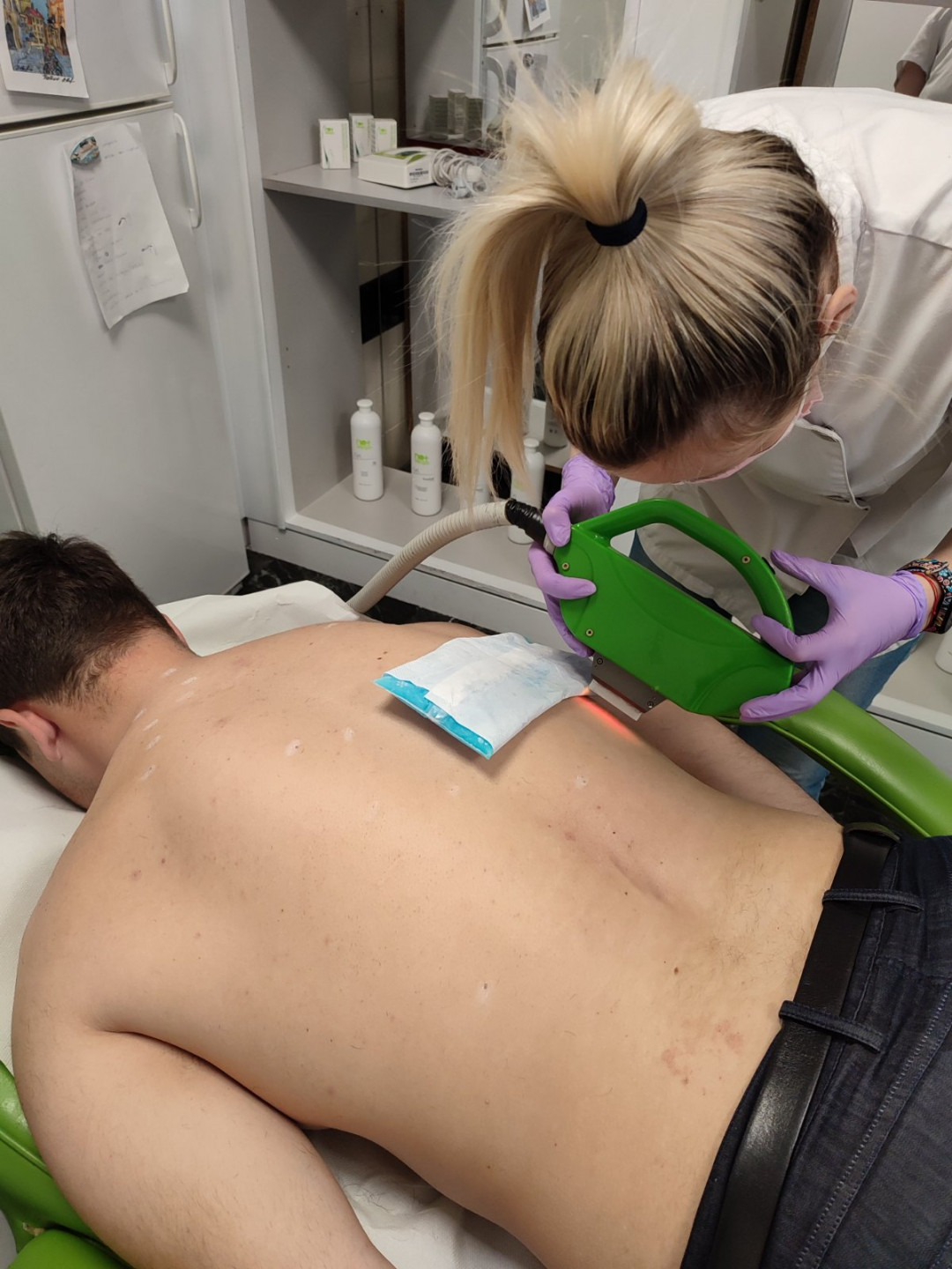 Epil Lux Centar #beograd Laserska epilacija Laserska epilacija celih leđa - za muškarce
