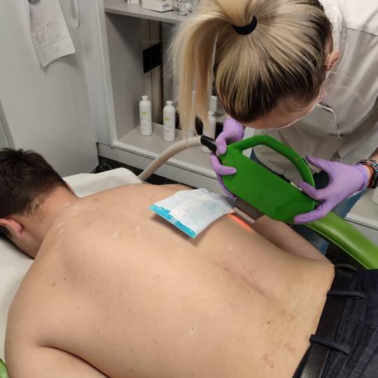 Epil Lux Centar #beograd Laserska epilacija Laserska epilacija celih leđa - za muškarce