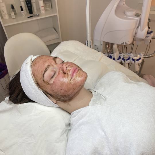 Monika Barta Cosmetics #novisad Tretman lica Higijensko čišćenje lica + phyto piling lica