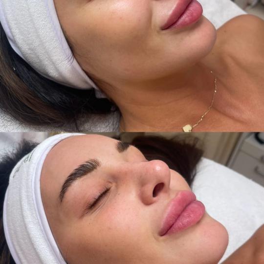 Choco Love #beograd Tretman lica PRX therapy PRX therapy
Prx t33 hemijski piling lica nije bez razl