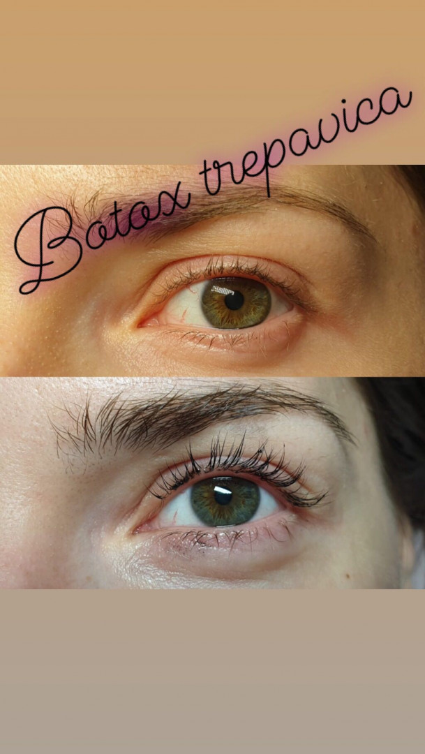 Be You #beograd Trepavice Lash lift + botox trepavica
