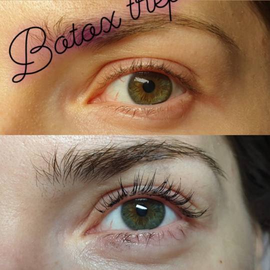 Be You #beograd Trepavice Lash lift + botox trepavica