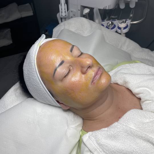 Monika Barta Cosmetics #novisad Kozmetički doktori Retinol piling lica - antiage