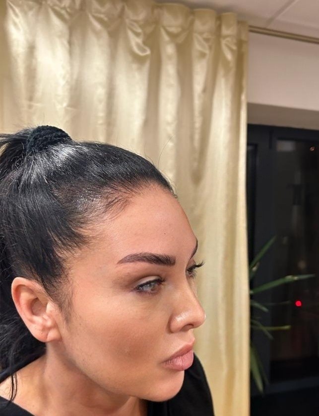 Esthetique Privé #beograd Trajna šminka Trajna šminka obrva - PHI BROWS MICROBLADING
