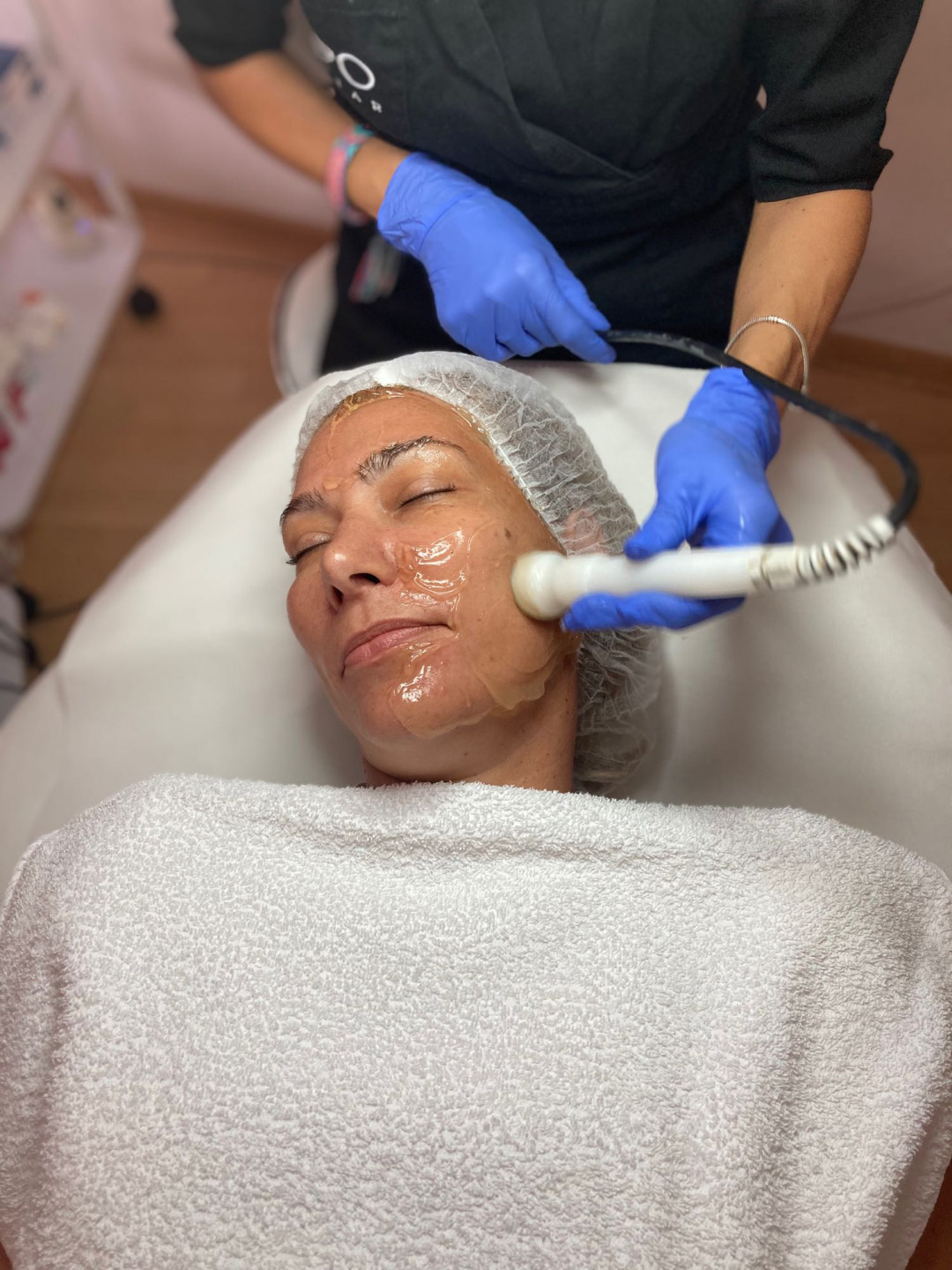 Radiotalasni lifting - lice - Lipo Centar, Beograd Tretman lica Lice Tretman lica, Beograd, Zvezdara