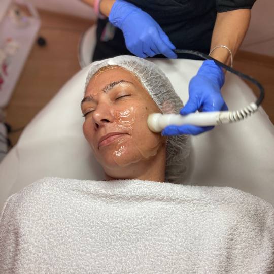 Lipo Centar #beograd Tretman lica Radiotalasni lifting - lice Preventivni anti age tretman zasnovan 